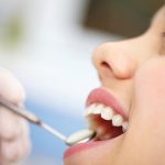 best dentist in lowell