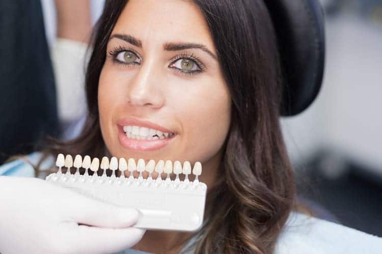 The Essential Benefits of Veneers
